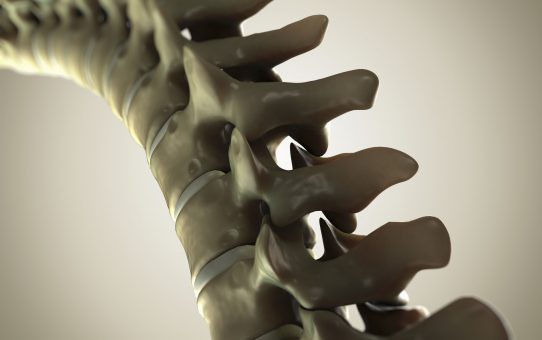 SPINAL FRACTURES: Growing Problem & Treatment