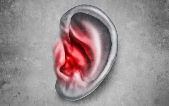 What is TINNITUS?