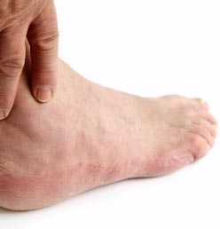 Foot Problems That Get Misdiagnosed!!